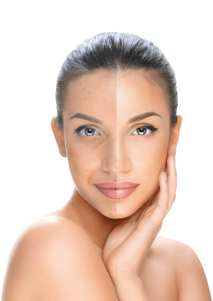 piperina-woman-1-1.png piperina-woman-1-1.png