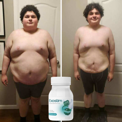 EXOSLIM-IMG3.png